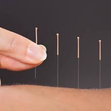 Acupuncture（pre-booking）