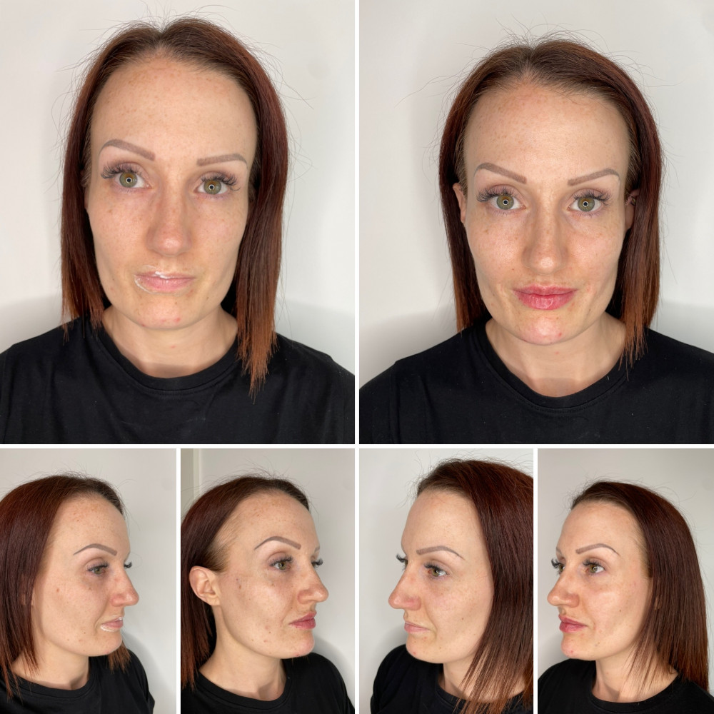 6ml Beautification Package