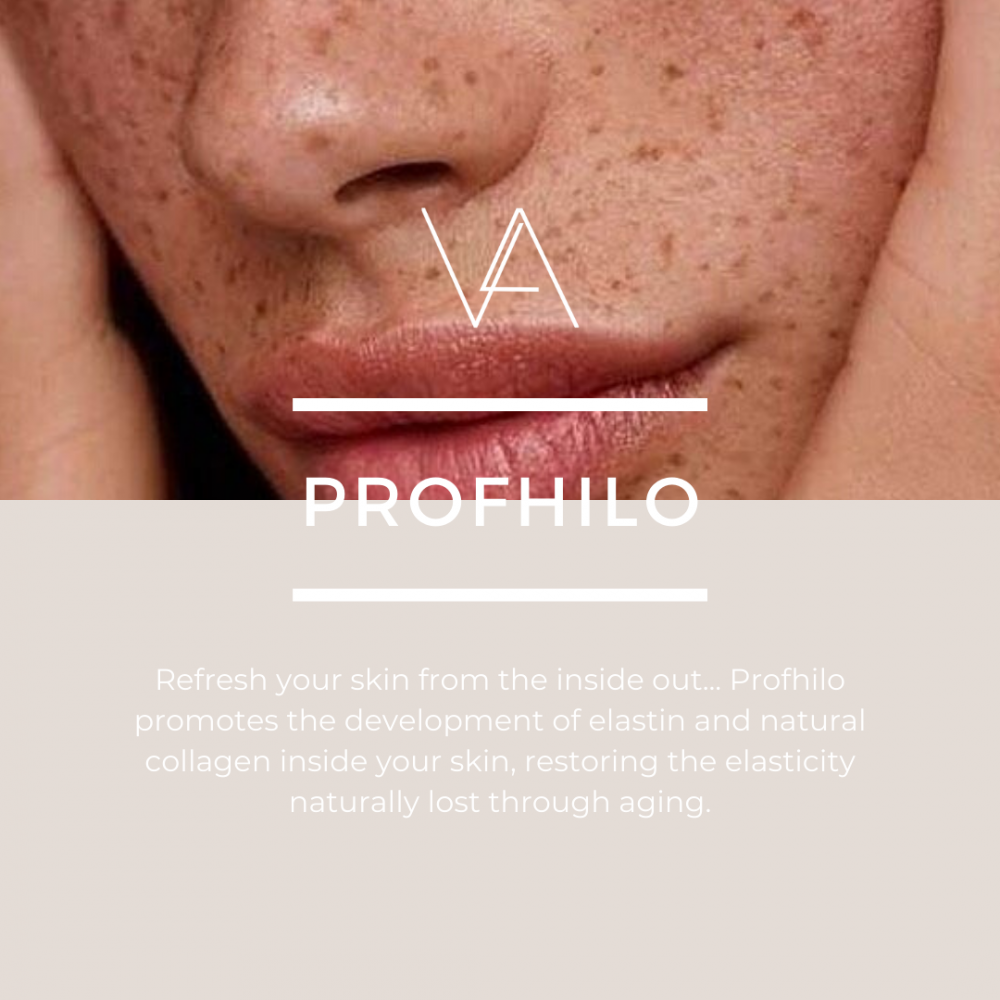 Profhilo treatment