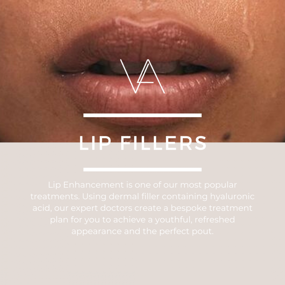 Lip filler treatments