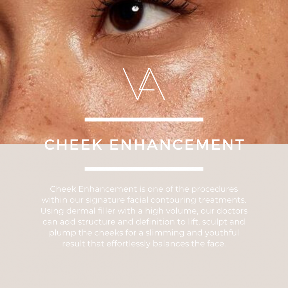 Cheek filler treatment