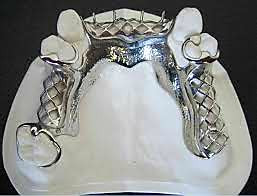 Chrome frame