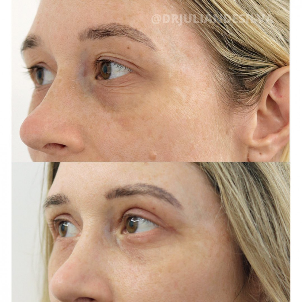 Centre for Advanced Facial Cosmetic and Plastic Surgery: Dr Julian de Silva Picture