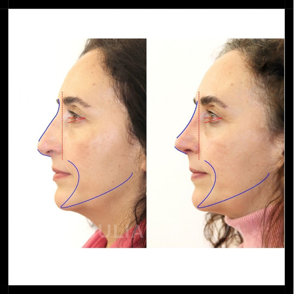 Centre for Advanced Facial Cosmetic and Plastic Surgery: Dr Julian de Silva Picture