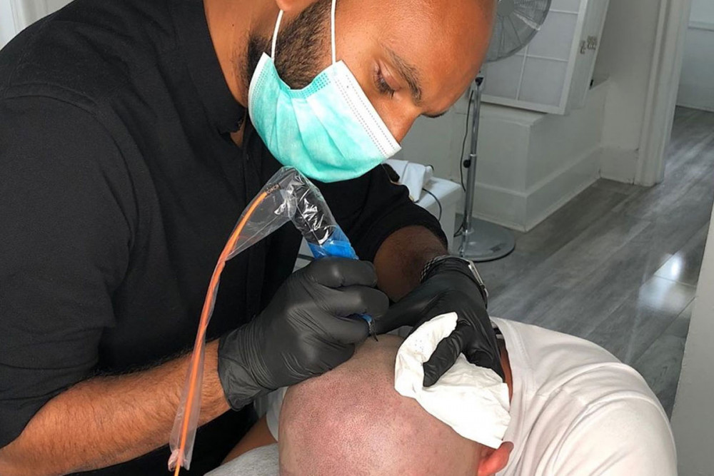Scalp Provoco image