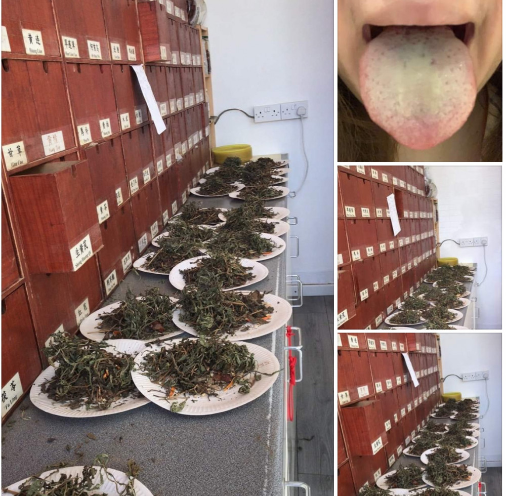 Traditional Chinese Herbal Medicine & Acupuncture Picture