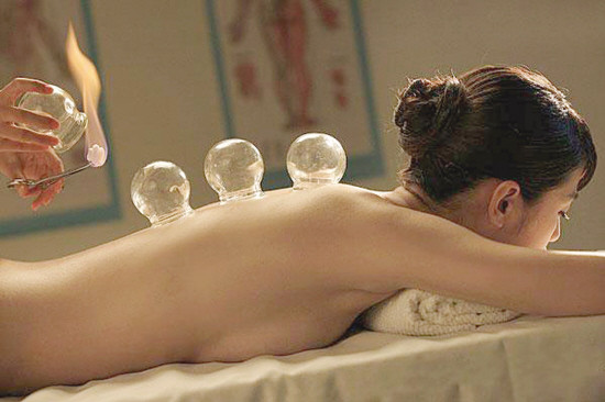 Cupping