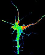 Wiring up the brain: How axons navigate? image