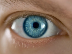 Laser Eye Treatment image