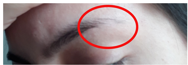 Review picture